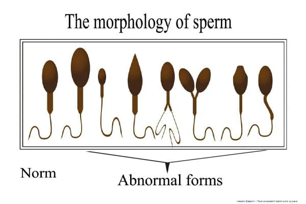 smoking-hinders-sperm-wellbeing