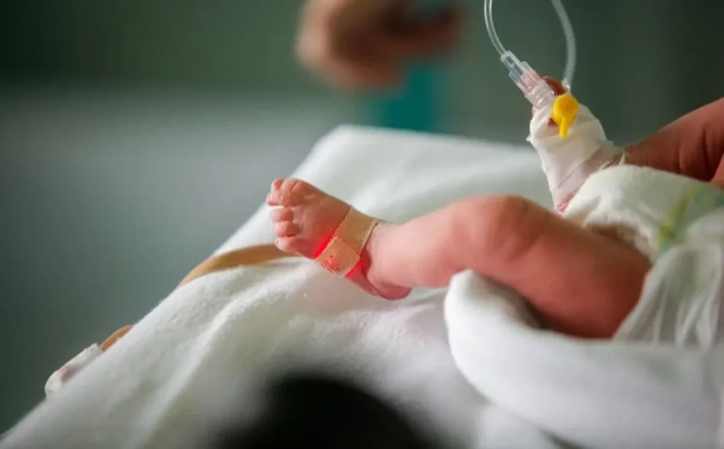 preterm-birth